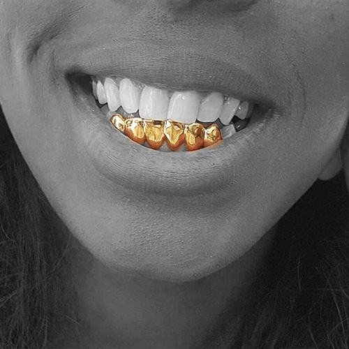 Gold bottom grillz